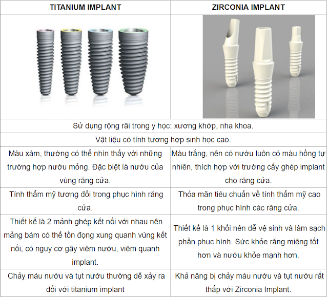 So sánh giữa Implant Zirconia và Implant Titanium